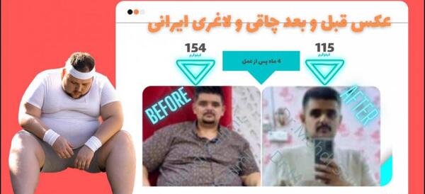 عکس قبل و بعد از چاقی