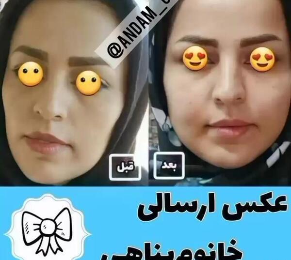 عکس قبل و بعد از چاقی