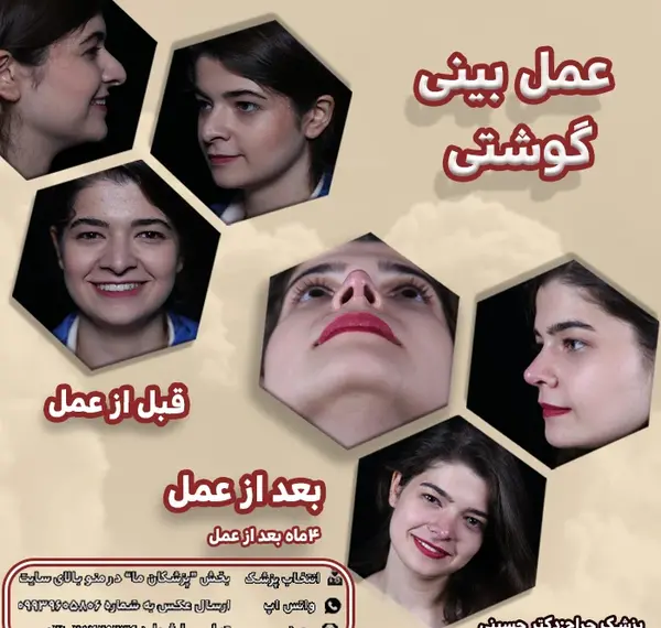 عکس قبل و بعد چهره