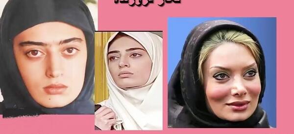 عکس قبل و بعد چهره
