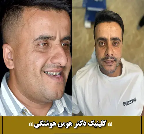عکس قبل و بعد چهره