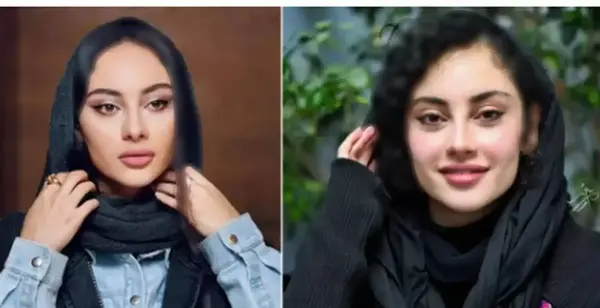عکس قبل و بعد چهره