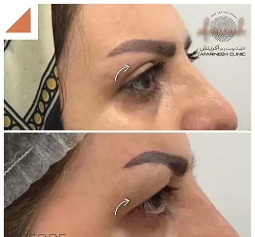 عکس های قبل از عمل چشم