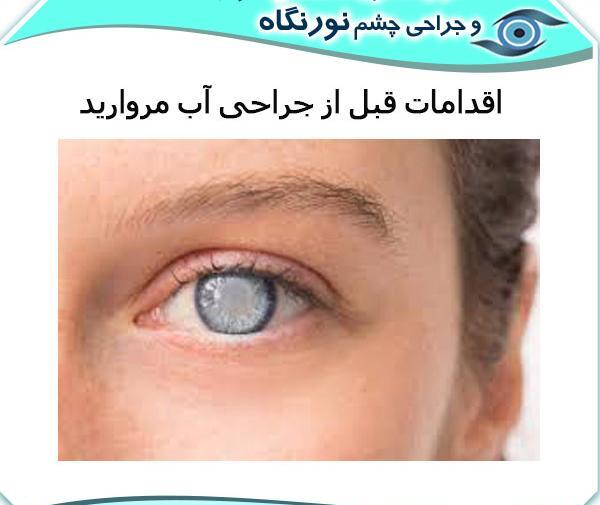 عکس های قبل از عمل چشم