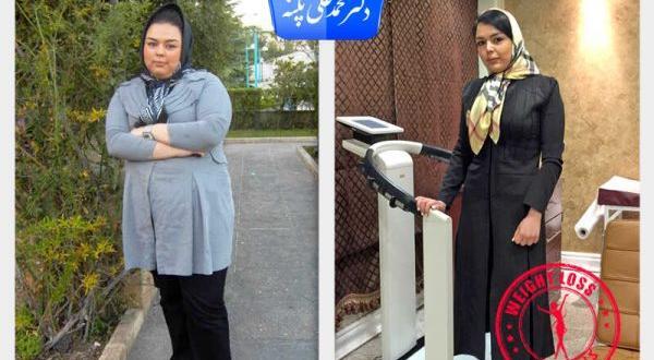 عکس قبل بعد چاقی