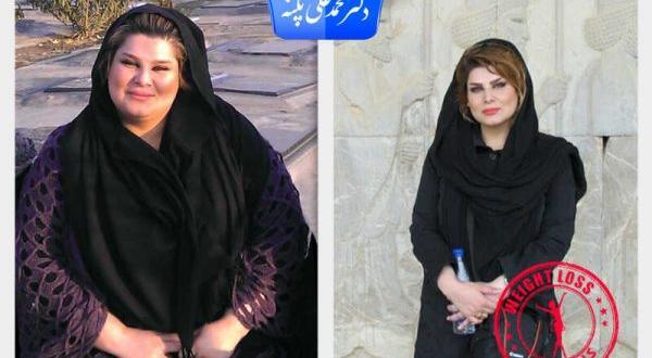 عکس قبل بعد چاقی