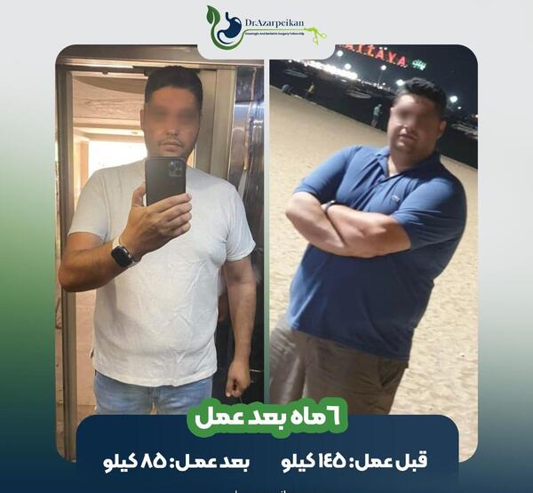 عکس قبل بعد چاقی