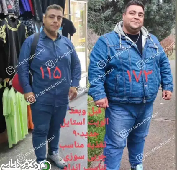 عکس قبل بعد چاقی