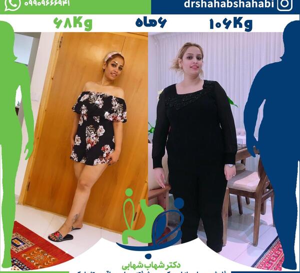 عکس قبل بعد چاقی