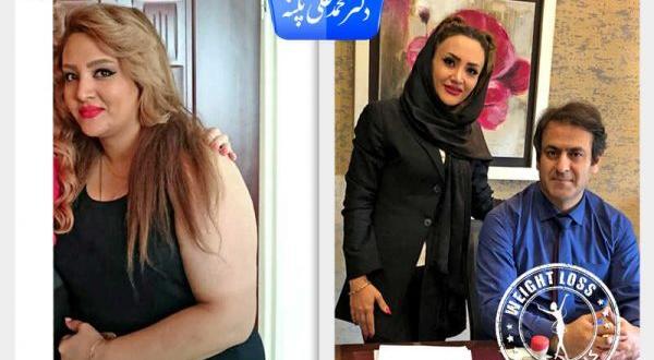 عکس قبل بعد چاقی
