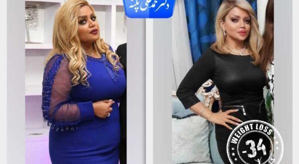 عکس قبل بعد چاقی