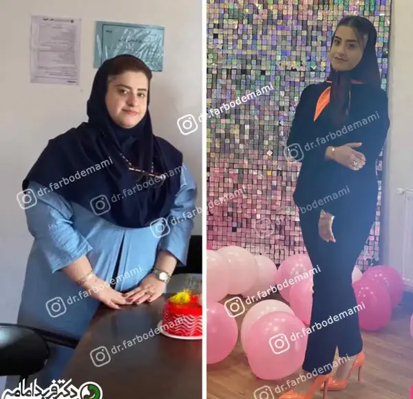 عکس قبل بعد چاقی