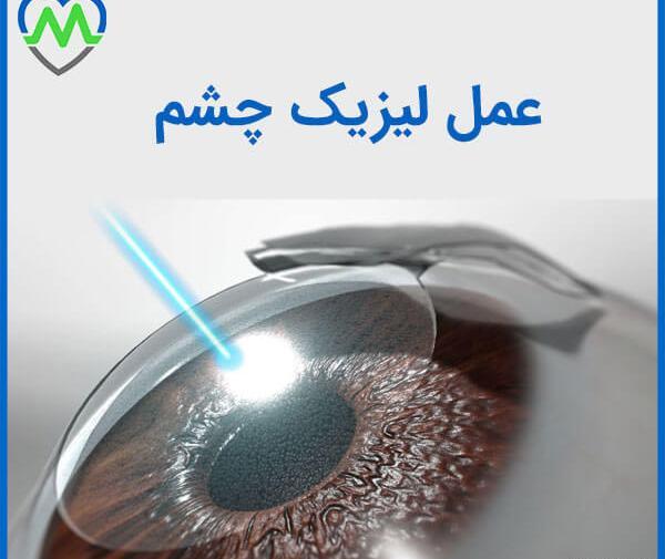عکس از چشم قبل از عمل لیزیک