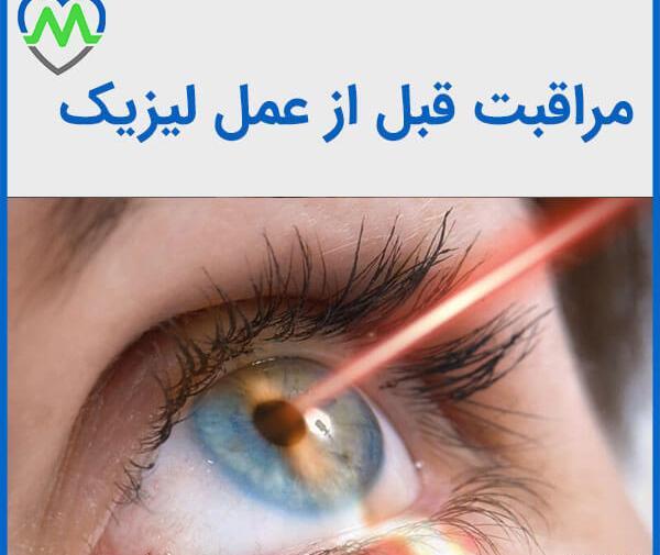 عکس از چشم قبل از عمل لیزیک