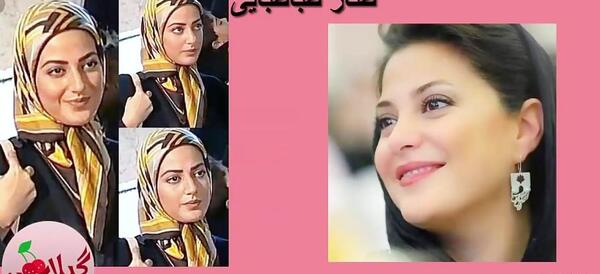 عکس قبل از جراحی نانسی عجرم