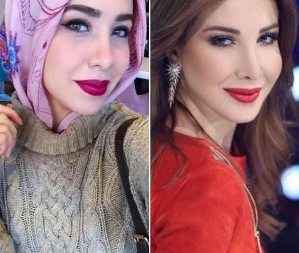 عکس قبل از جراحی نانسی عجرم
