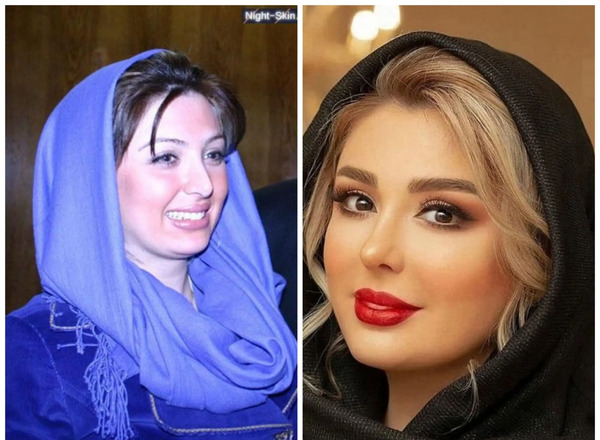عکس نیوشا ضیغمی قبل از عمل جراحی