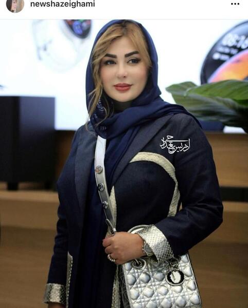 عکس نیوشا ضیغمی قبل از عمل جراحی