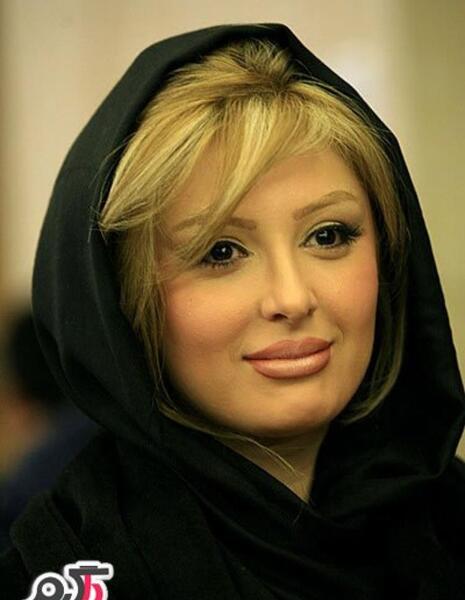 عکس نیوشا ضیغمی قبل از عمل جراحی