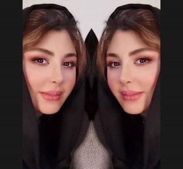عکس نیوشا ضیغمی قبل از عمل جراحی