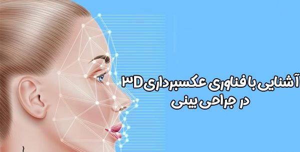 عکس برداری قبل از جراحی بینی