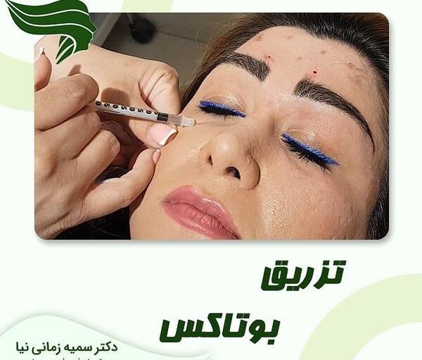 عکس قبل و بعد بوتاکس پیشانی