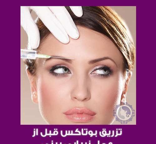 عکس قبل و بعد بوتاکس بینی
