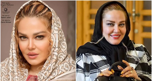 عکس قبل عمل بهاره رهنما
