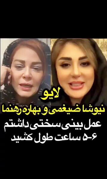 عکس قبل عمل بهاره رهنما