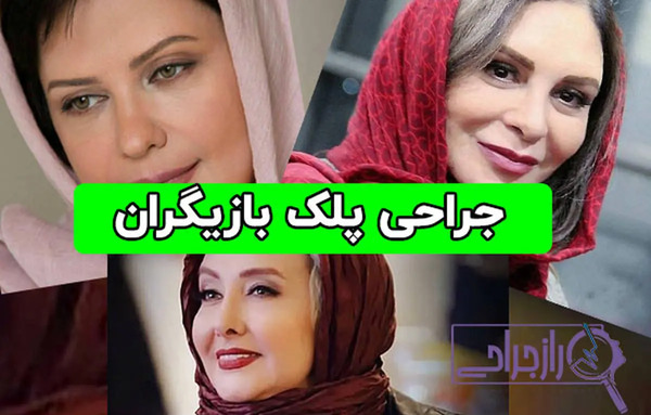 عکس قبل عمل بهاره رهنما