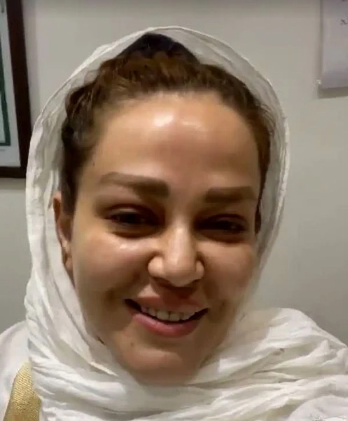 عکس قبل عمل بهاره رهنما