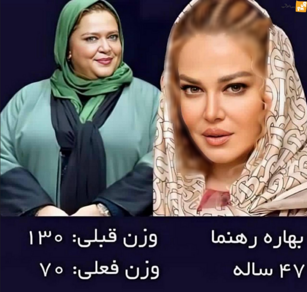 عکس قبل عمل بهاره رهنما