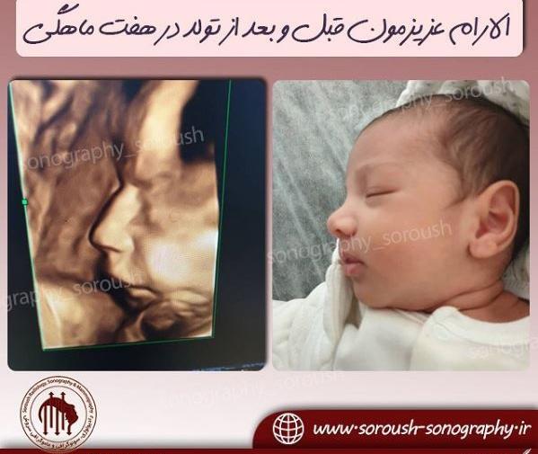 عکس جنین قبل از تولد
