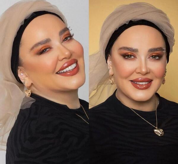 عکس قبل و بعد بهاره رهنما