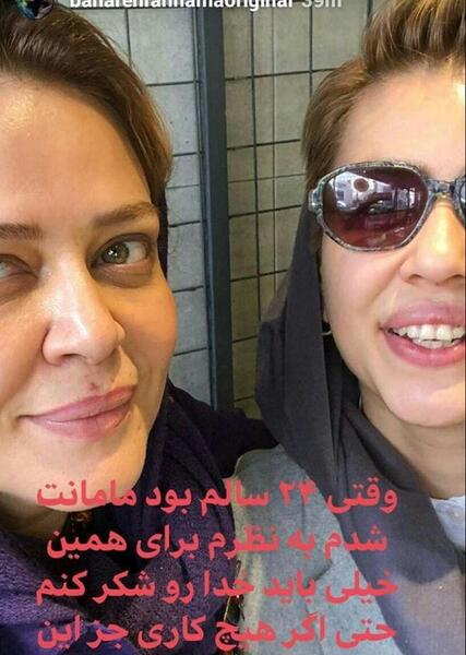 عکس قبل و بعد بهاره رهنما