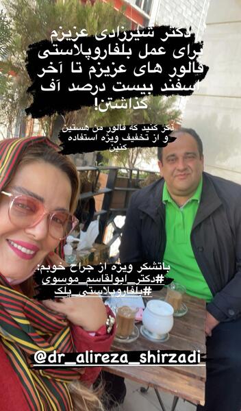 عکس قبل و بعد بهاره رهنما