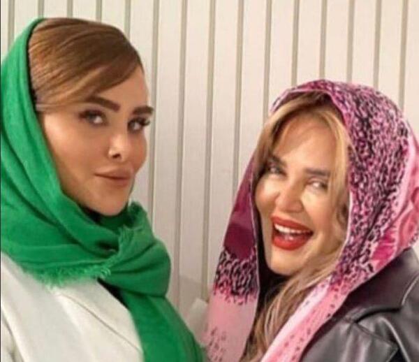 عکس قبل و بعد بهاره رهنما