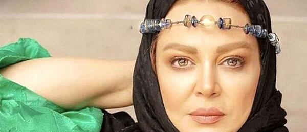 عکس قبل از عمل بهاره رهنما