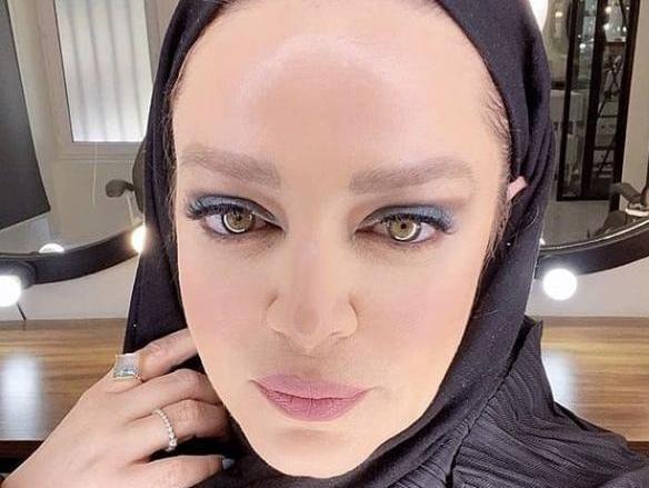 عکس قبل از عمل بهاره رهنما