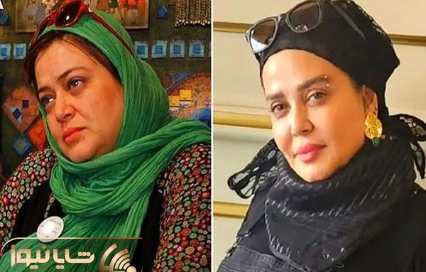 عکس قبل از عمل بهاره رهنما