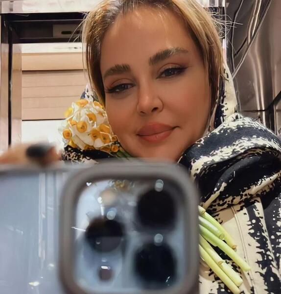 عکس قبل از عمل بهاره رهنما