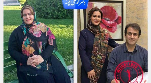 عکس قبل و بعد لاغری بهاره رهنما