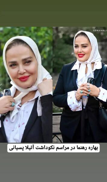عکس قبل و بعد لاغری بهاره رهنما