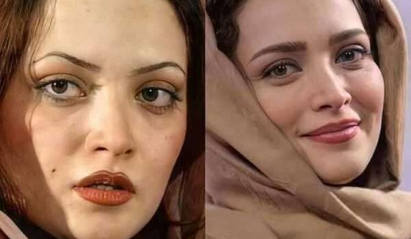 عکس قبل عمل بهنوش طباطبایی