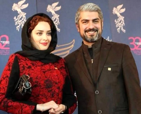عکس قبل عمل بهنوش طباطبایی