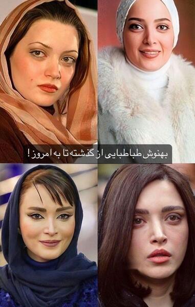 عکس های قبل عمل بهنوش طباطبایی