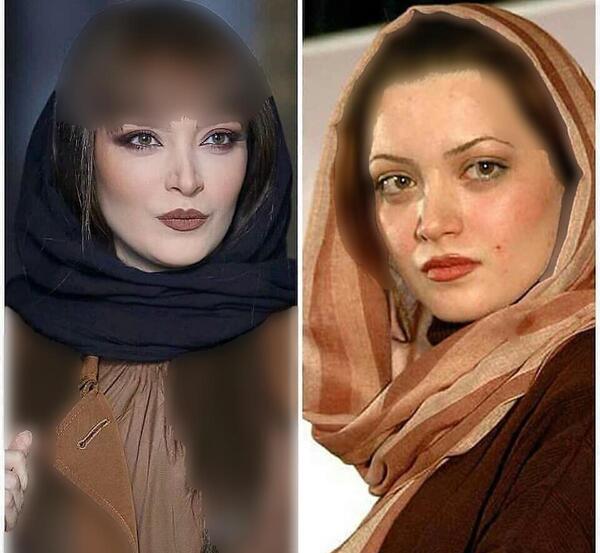 عکس های قبل عمل بهنوش طباطبایی