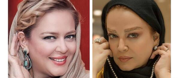 عکس قبل از عمل بینی بهنوش طباطبایی
