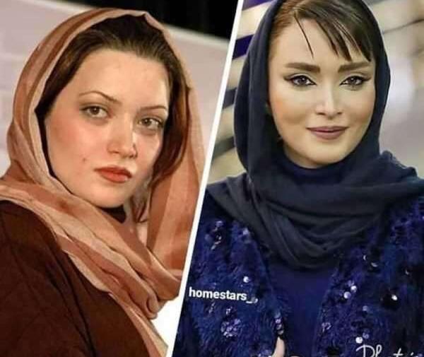 عکس قبل از عمل بینی بهنوش طباطبایی