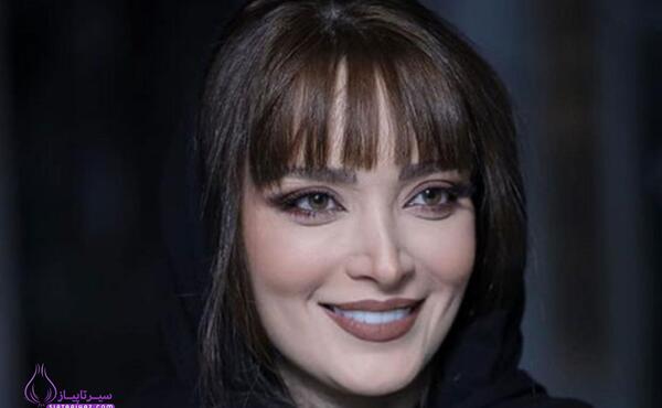 عکس قبل از عمل بینی بهنوش طباطبایی